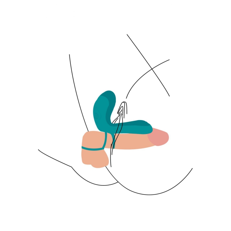 Alternative view of Couples Stimulator Ring Green